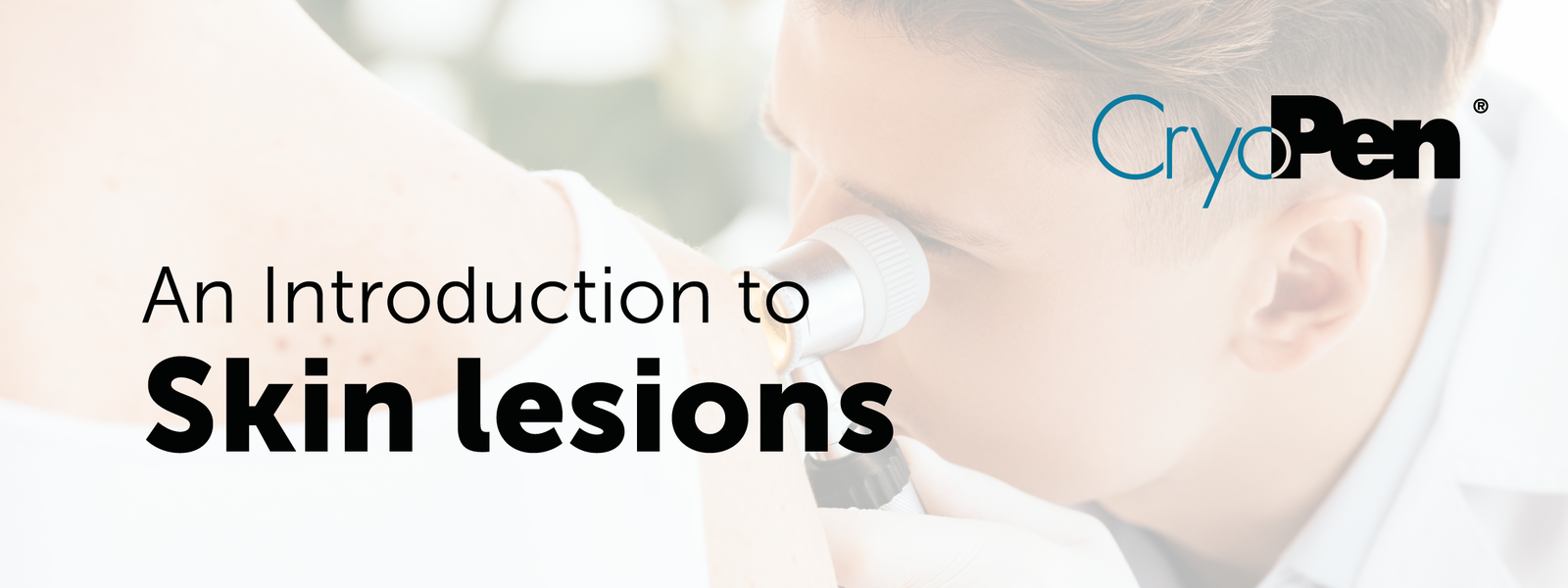 CryoPen Skin Lesion | All You Need To Know