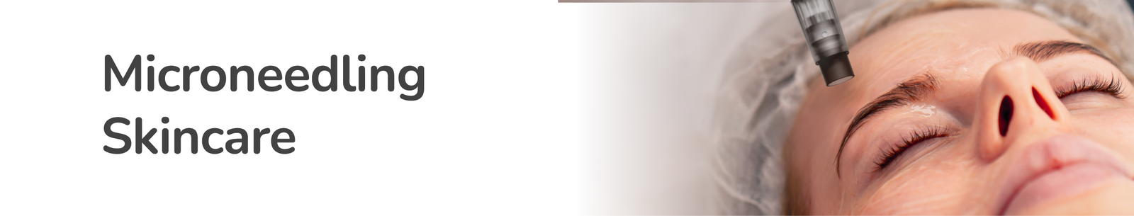 Does Microneedling Hurt? Everything You Need To Know