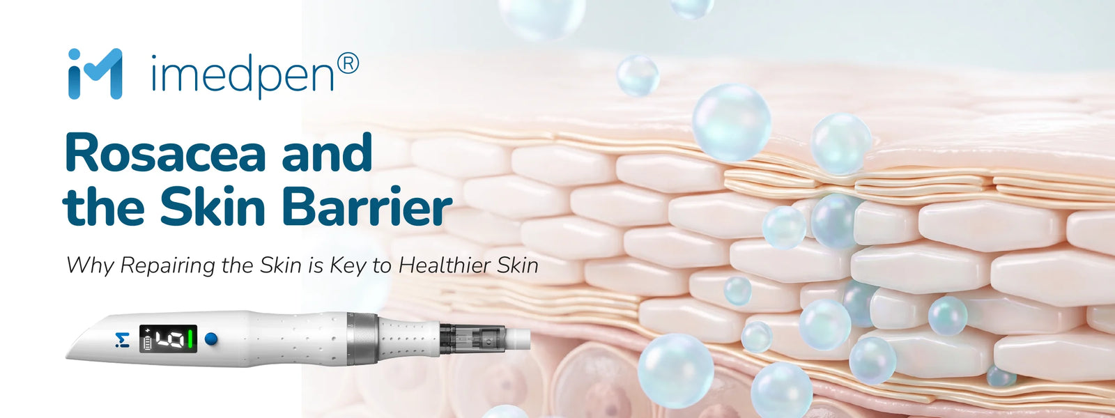 Rosacea And The Skin Barrier: Why Repairing The Skin Is Key To Healthier Skin