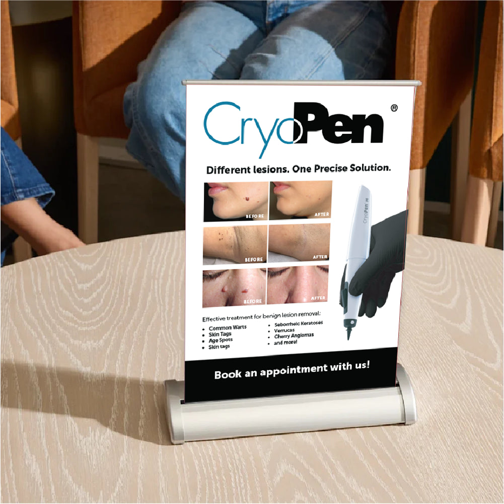 CryoPen® M Tabletop Pull-Up Banner (A4) with Cartridges
