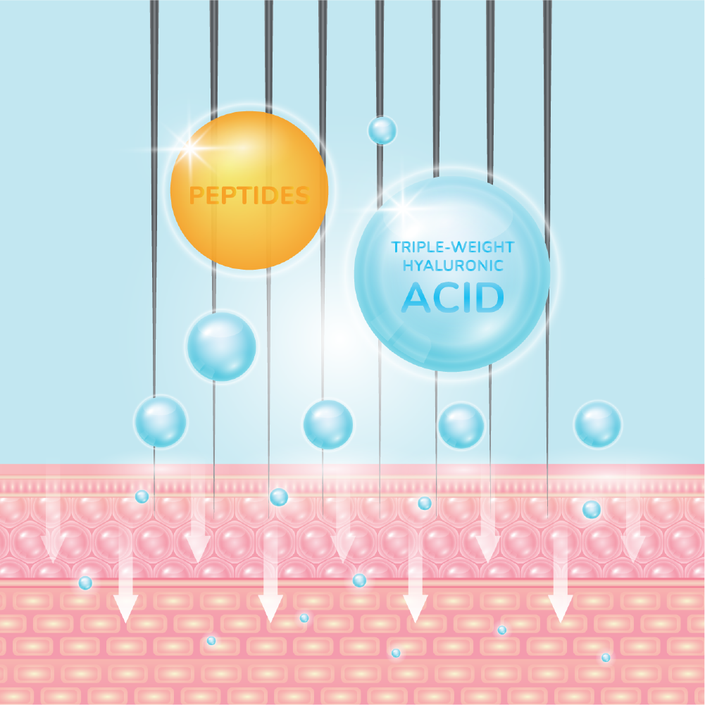 imedpen® Solutions GLIDE