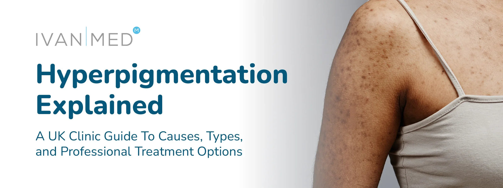 Hyperpigmentation Explained: A UK Clinic Guide To Causes, Types, And Professional Treatment Options