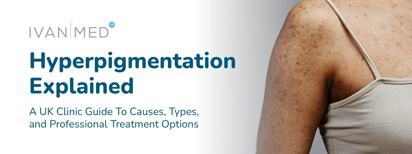 Hyperpigmentation Explained: A UK Clinic Guide To Causes, Types, And Professional Treatment Options