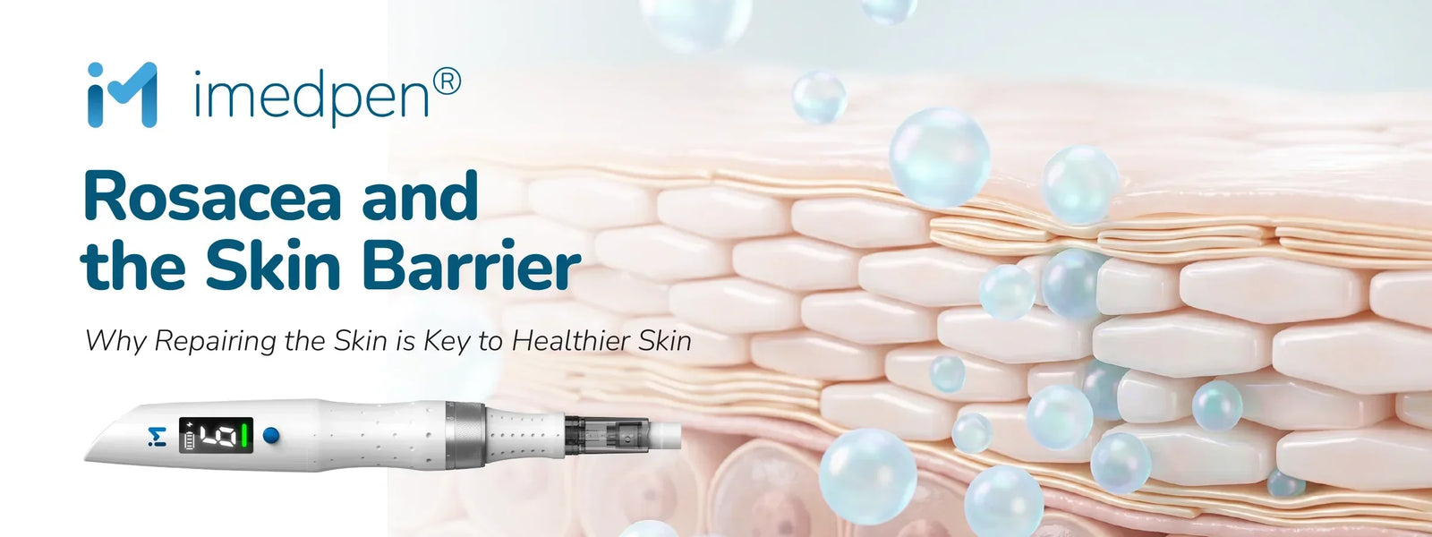 Rosacea And The Skin Barrier: Why Repairing The Skin Is Key To Healthier Skin