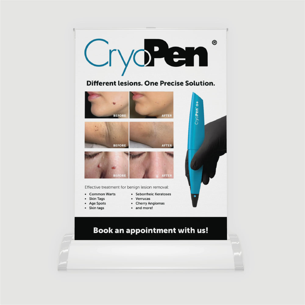 CryoPen® O+ Tabletop Pull-Up (A4) with Cartridges