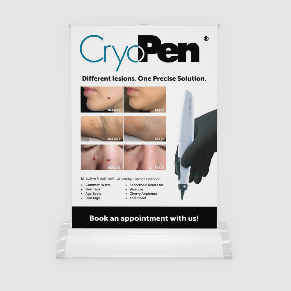 CryoPen® M Tabletop Pull-Up Banner (A4) with Cartridges