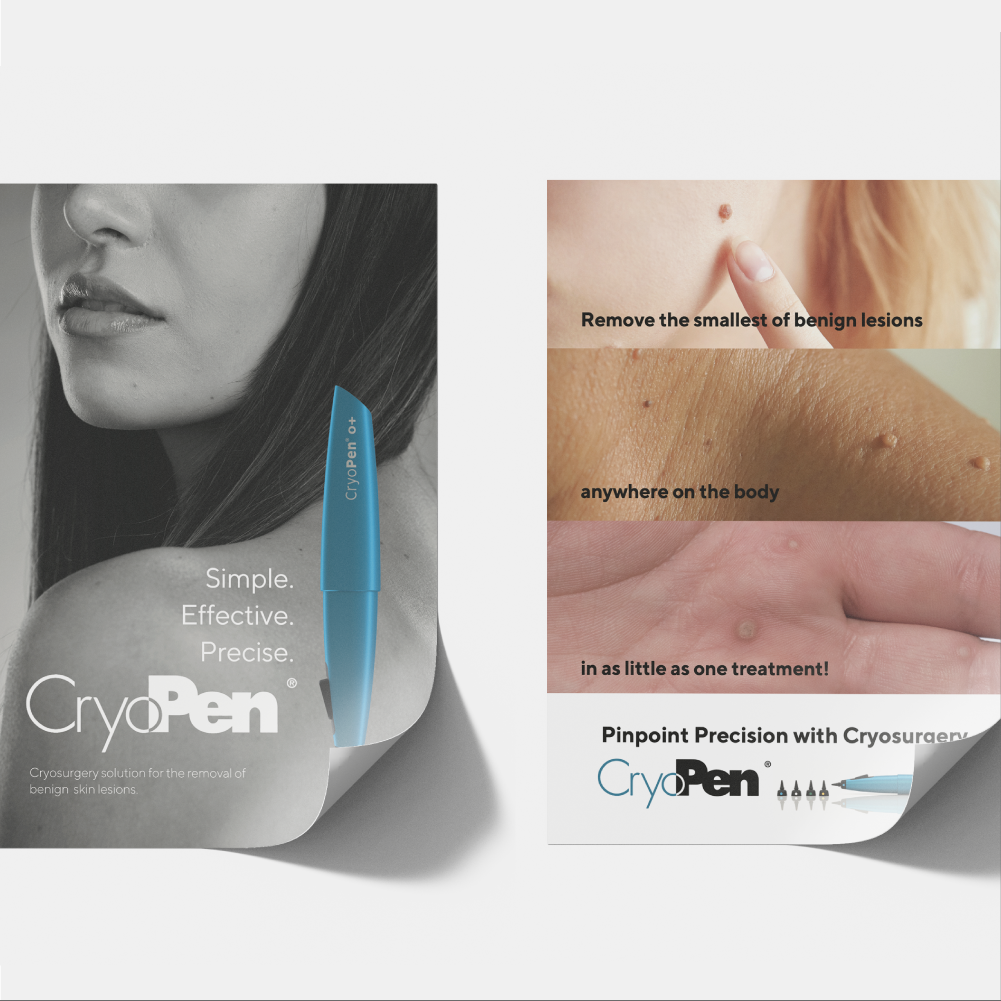 CryoPen® Poster (A3)