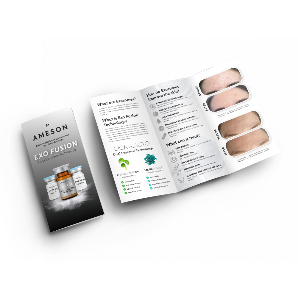 AMESON Exo Fusion Treatment Flyers (50 pack)