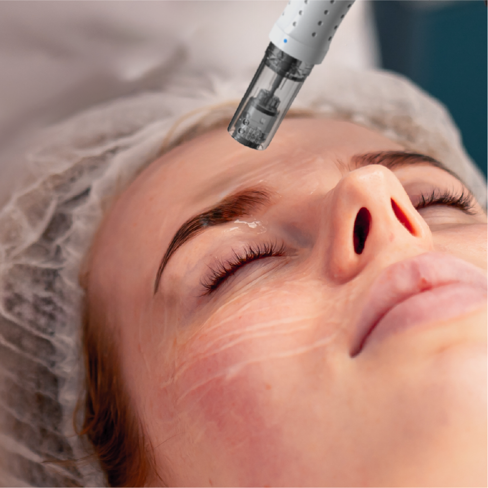 imedpen® Solutions GLIDE