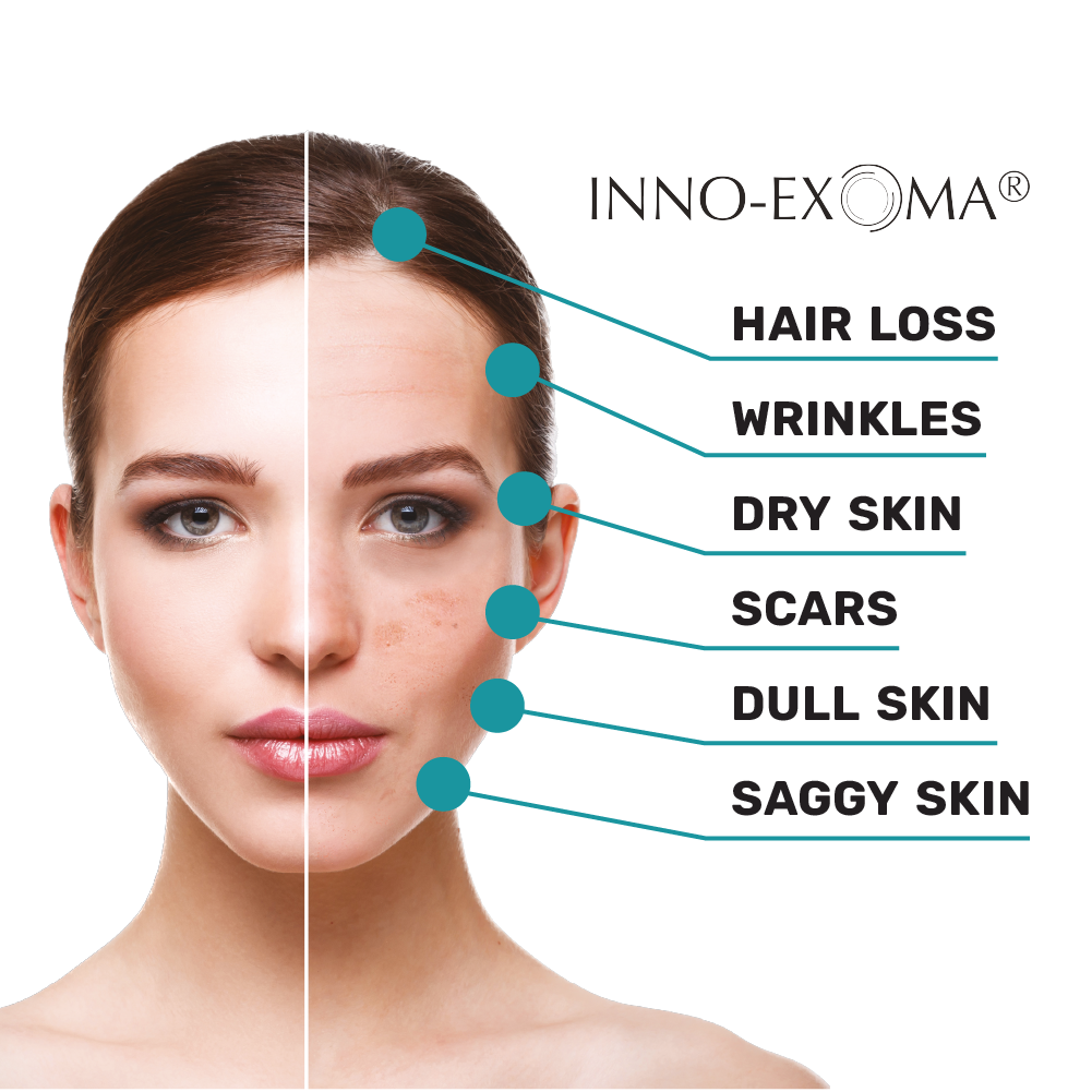 INNO-EXOMA® EXO-SKIN