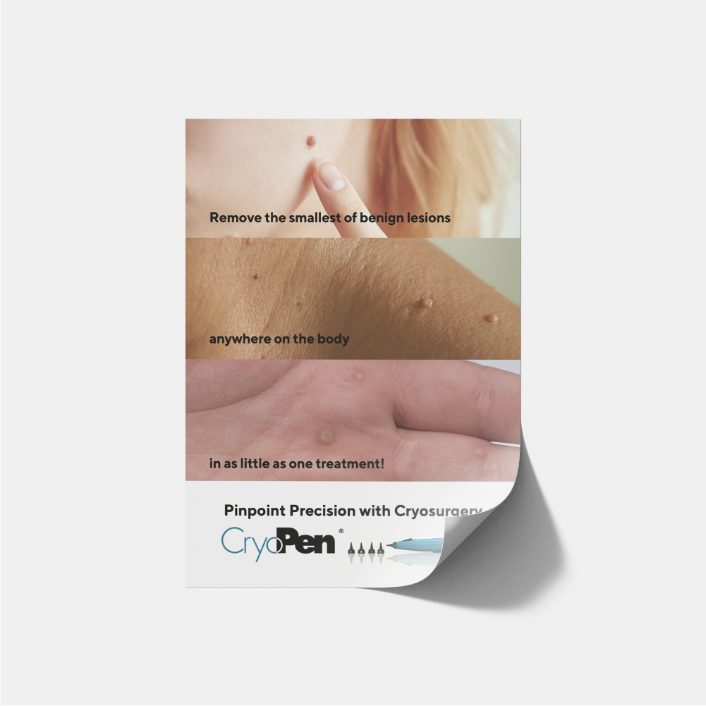 CryoPen® Poster (A3)