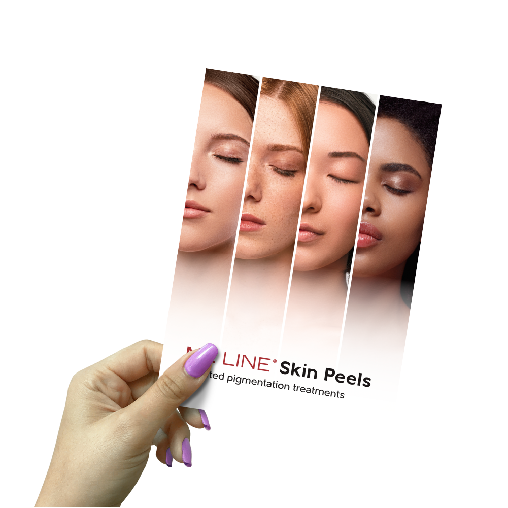 MELINE Treatment Flyers (50 pack)